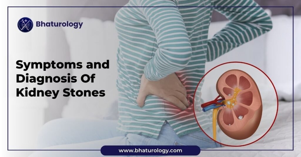 Symptoms and Diagnosis of Kidney Stones