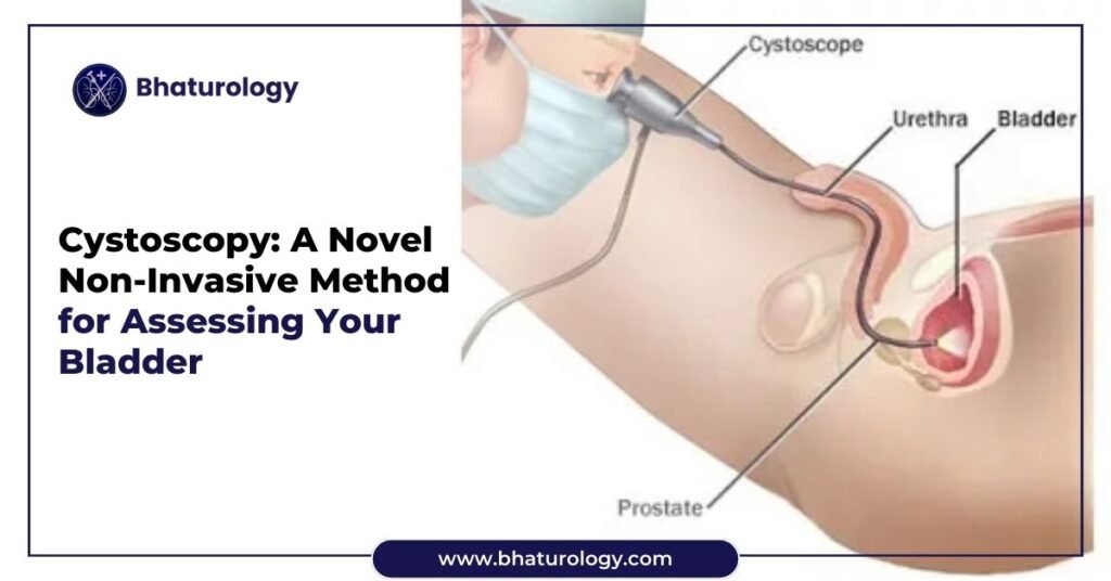 Cystoscopy