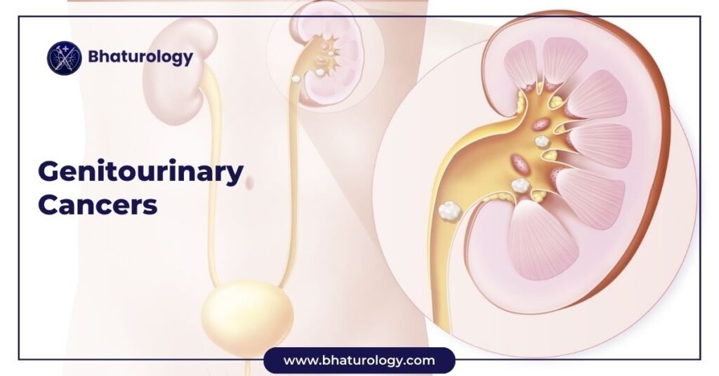 Genitourinary Cancers